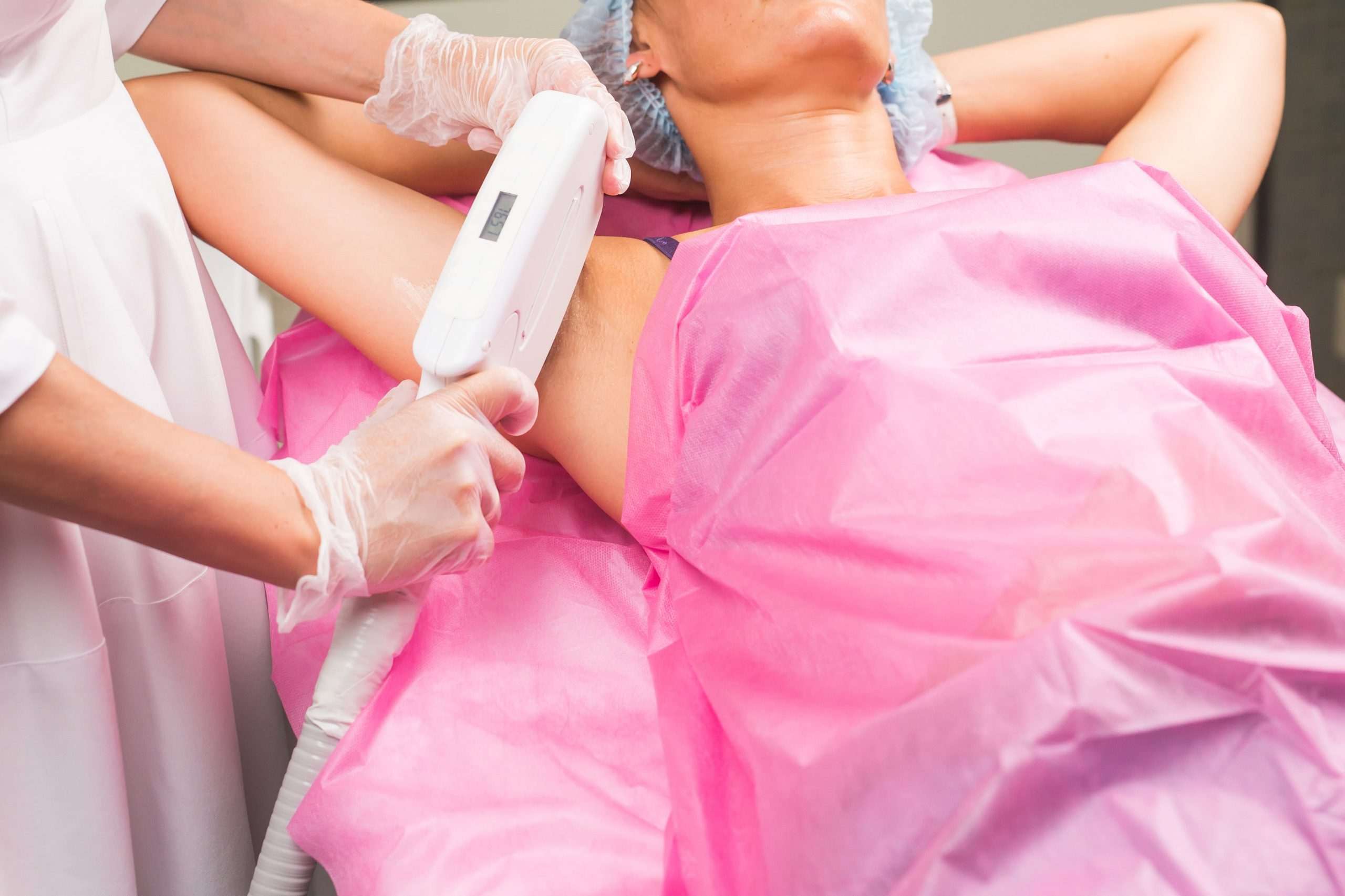 spa–concept-woman-having-underarm laser hair removal epilation Spa, people and cosmetology concept - Woman having underarm laser hair removal epilation
