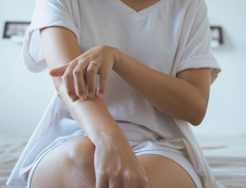 10 Things That May Make Your Eczema Worse